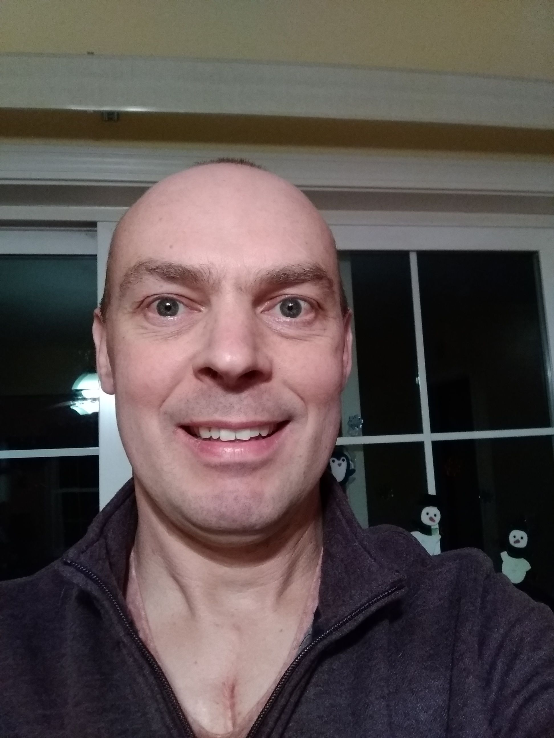 Today I am 4 weeks since surgery. I'm feeling great, walking everyday and getting some good rest. No real pain in my chest except for a little tightness that seems to move around from day to day. I had a great Christmas and plan to have a Happy New year.
