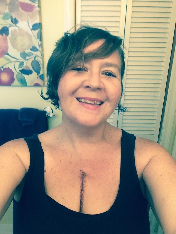 This is the new me. Can't wait for the glue to come off.