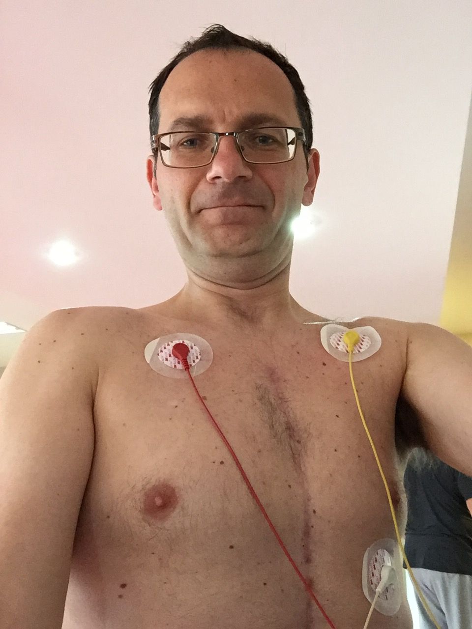Thu, 6th October 2016
Six months after my second heart surgery in the cardiac rehabilitation in the Portiuncula Hospital in Ballinasloe, Co. Galway, Republic of Ireland