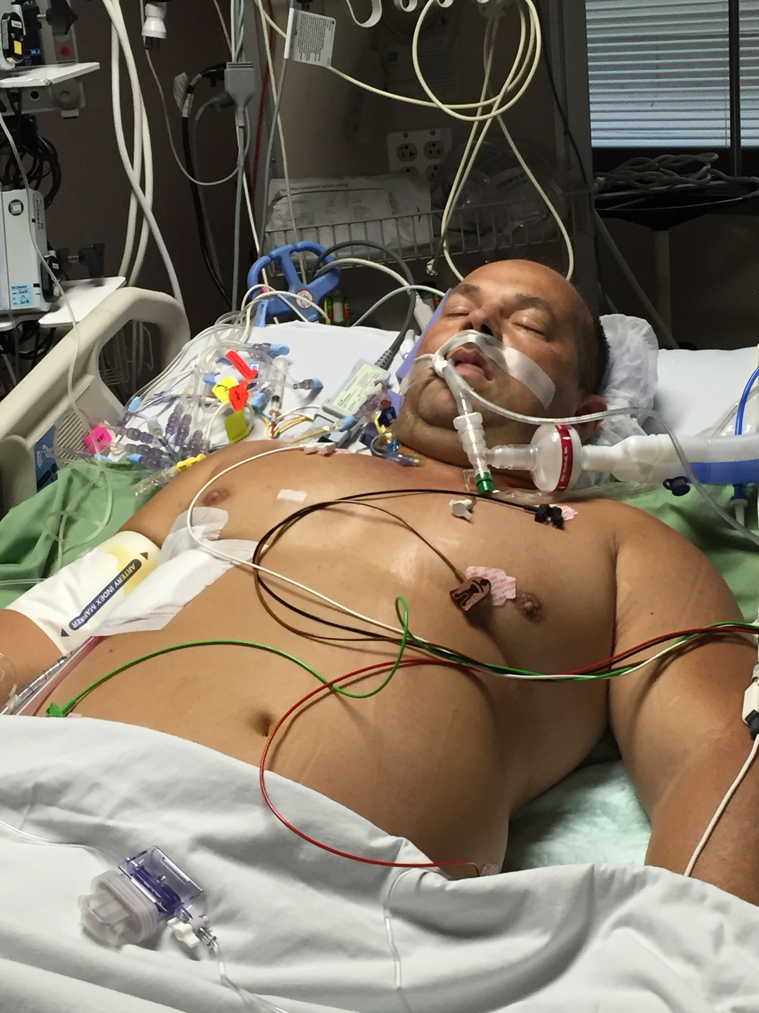 Hard to believe this is what I looked like 18 months ago. Time sure has flew by.
Had my check up and Mitral valve repair is still intact and looking good.
Still not happy with my workouts and some other small things to work on but I do feel great.
I