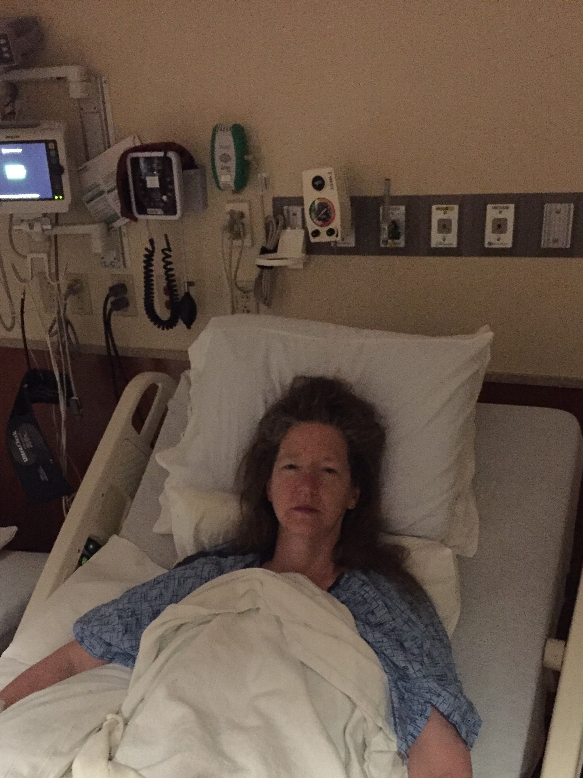 May 31, 2017! Before the surgery.