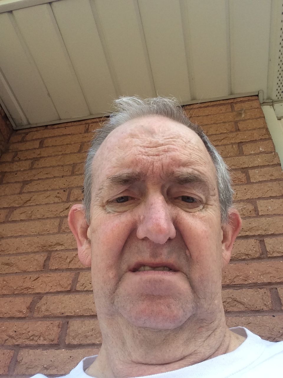 Before Surgery