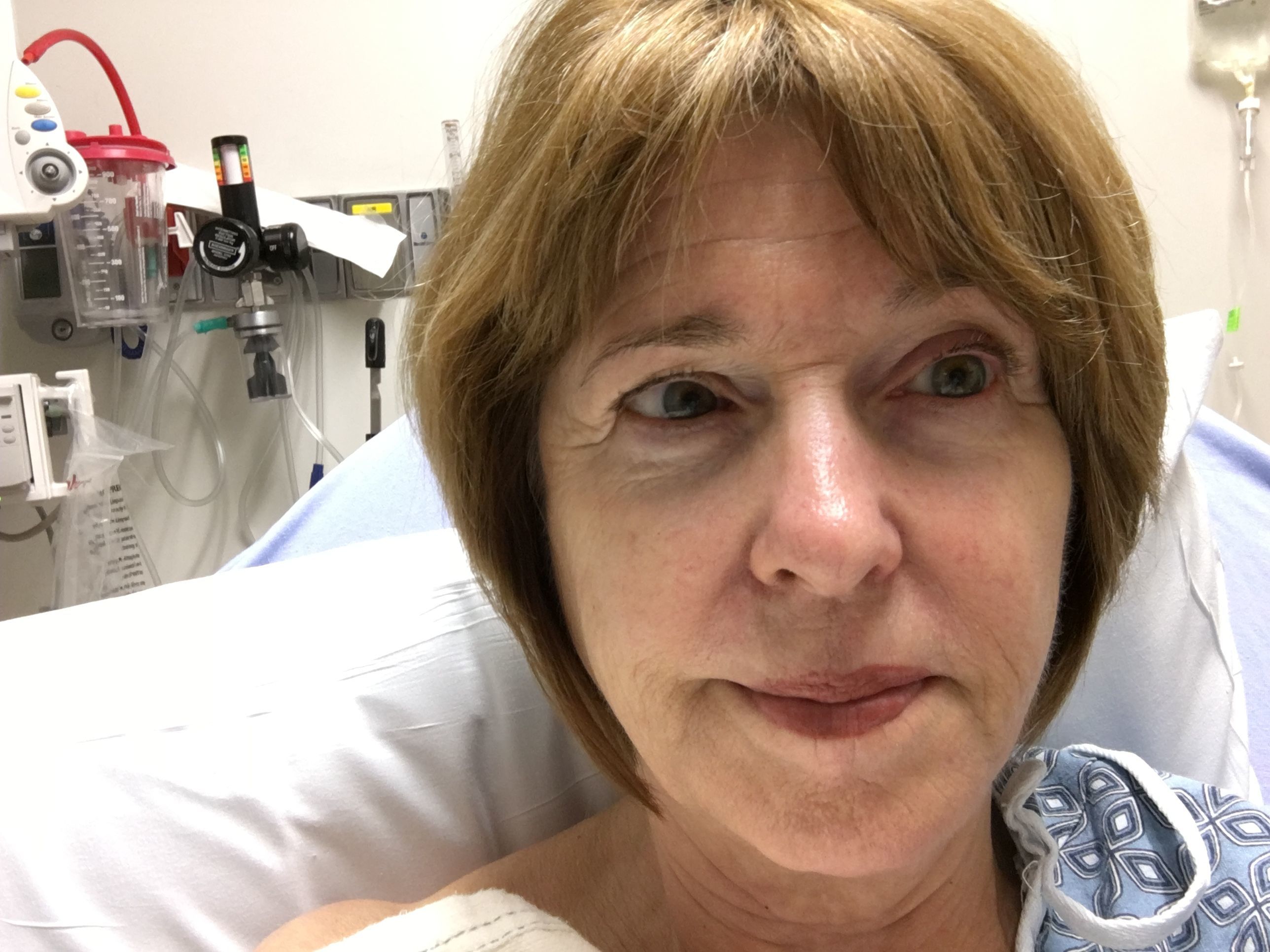 In the hospital for my pre-op heart cath. All the arteries are clear!
One more hurtle surmounted. I just hope I can get all my questions addressed at my pre- op conference. My psychologist cousin gave me some relaxation CDs to listen to the two weeks pr