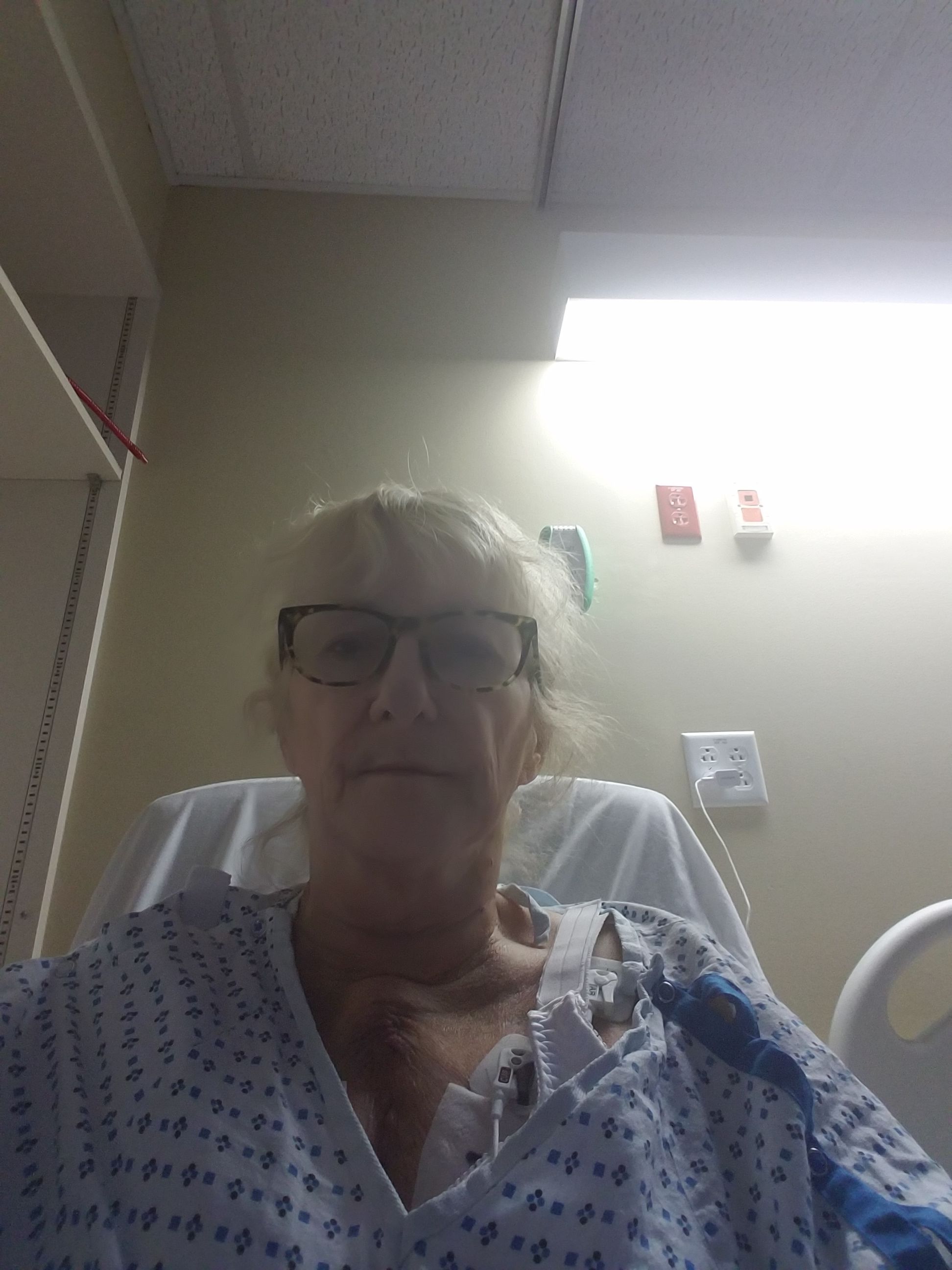 Here I am hoping to go home tomorrow.i have a scar now too. Found out that I have1 pig valve and one cow valve. I have a oink/moo. It is difficult to sleep