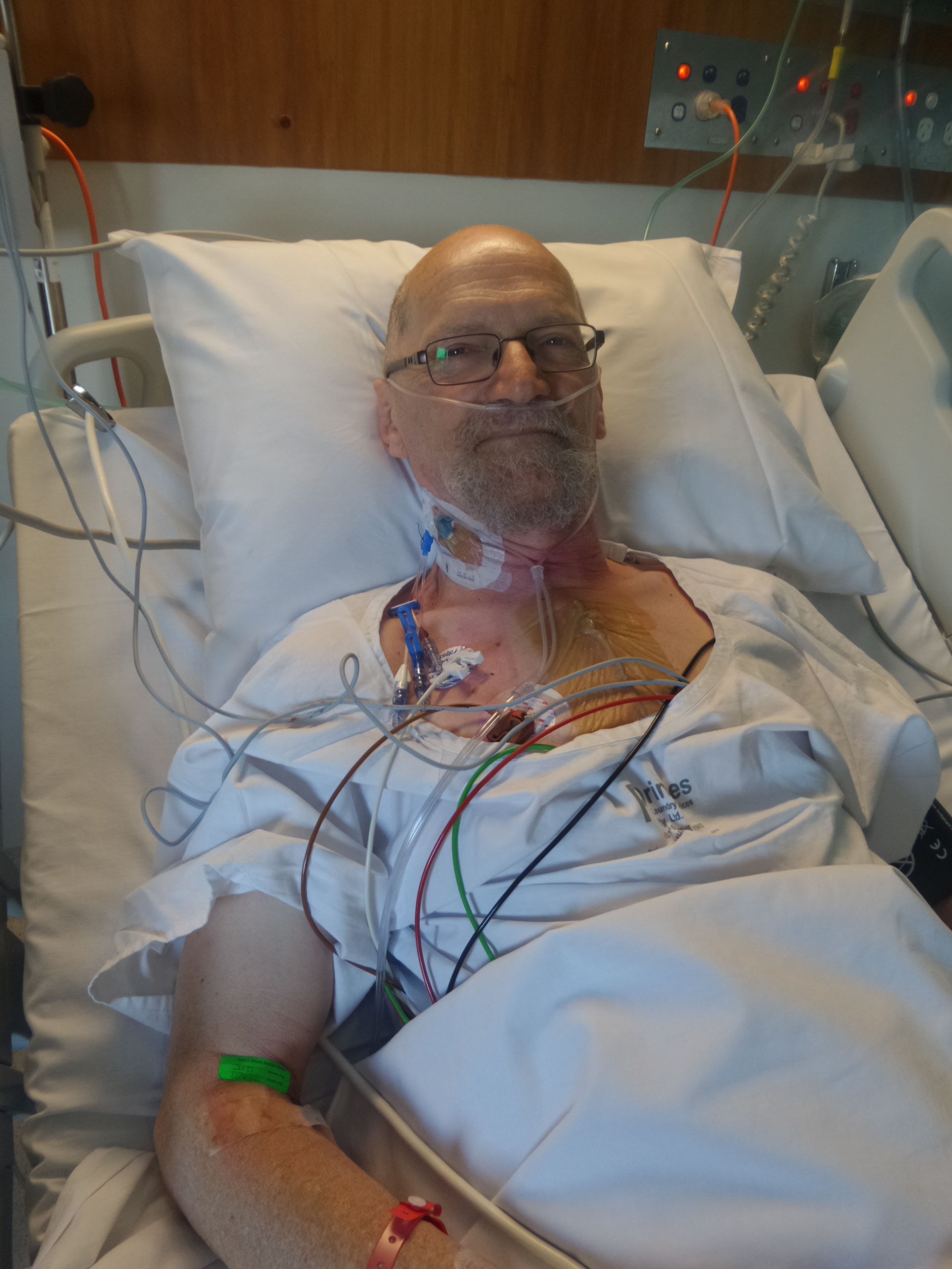 In ICU on the morning of Saturday the 14th, with my new On-X aortic valve in place :)