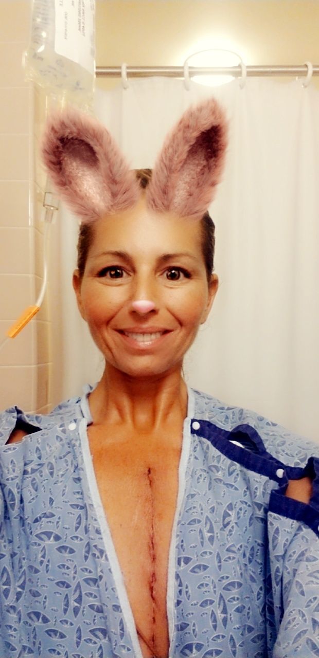 1 wk post op today, STILL in hospital so trying to humor myself while showing off new fabulous scar! Cumidin levels are going down instead of up, VERY fustrated but trying to stay optimistic!