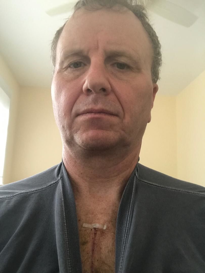 4 weeks out still alive.