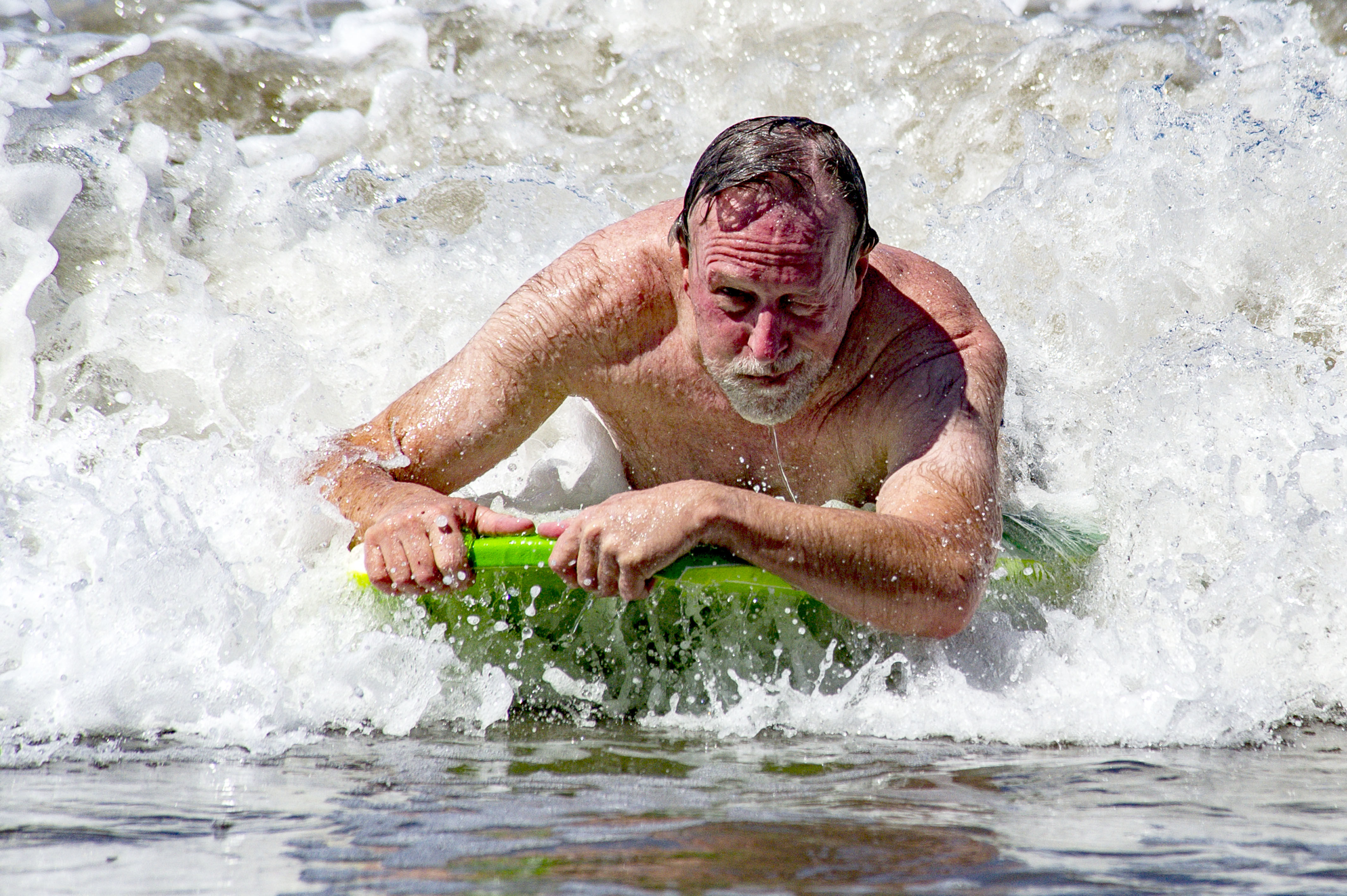 Picture taken 17 weeks Post Op - trying to keep salt water out of my eyes while boogie boarding the pacific ocean in Nicaragua. You folks waiting for your surgical dates - don't forget that you are going to feel SO much better when you get to the other
