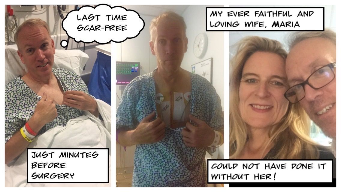 Going through my photos on my phone I thought about the one on the left. That is the last picture taken of me "pre-scar". My wife loves my new scar. She has been a rock and I could not have done this without her!