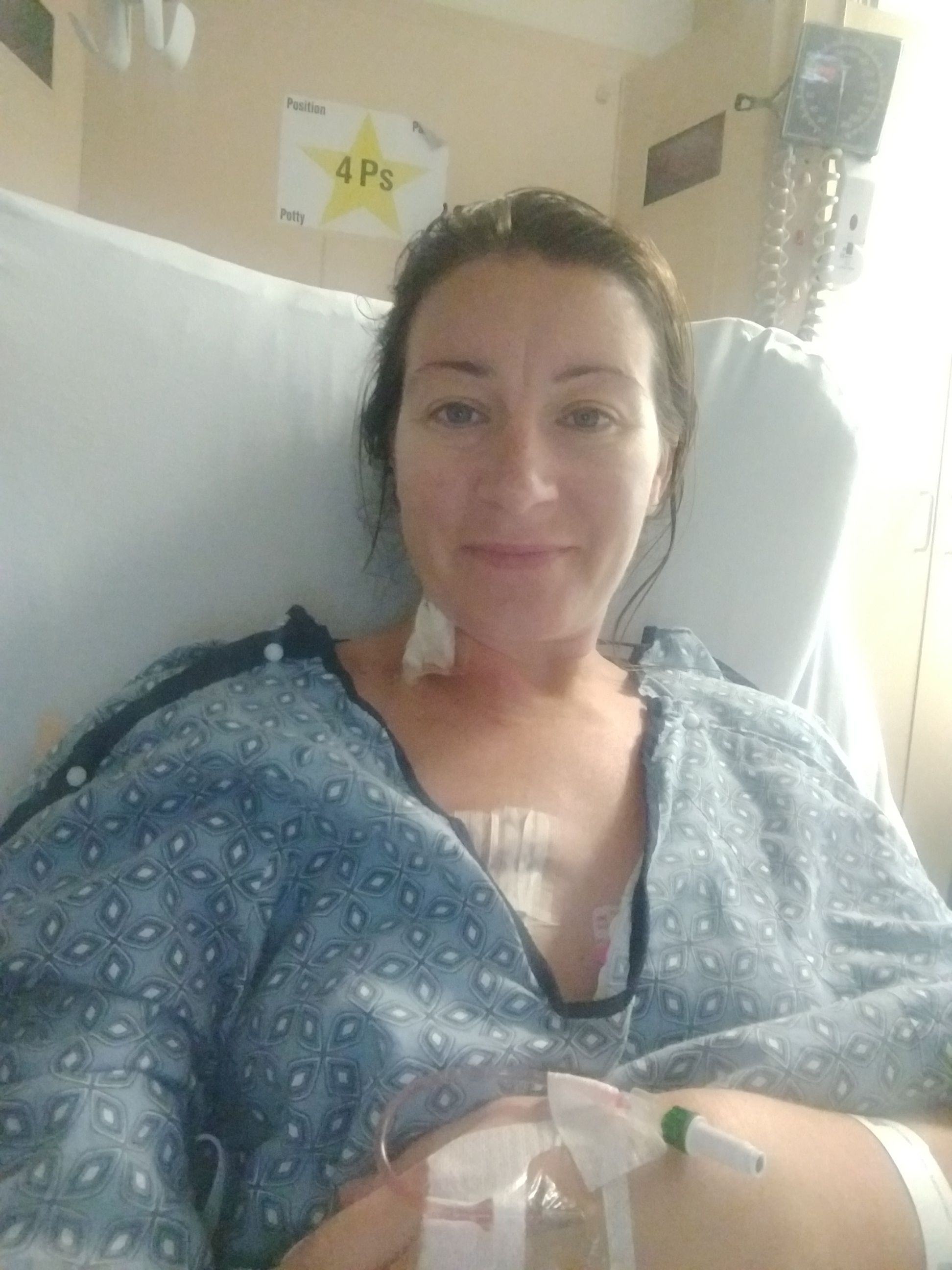 4 days post op and possibly going home today!!