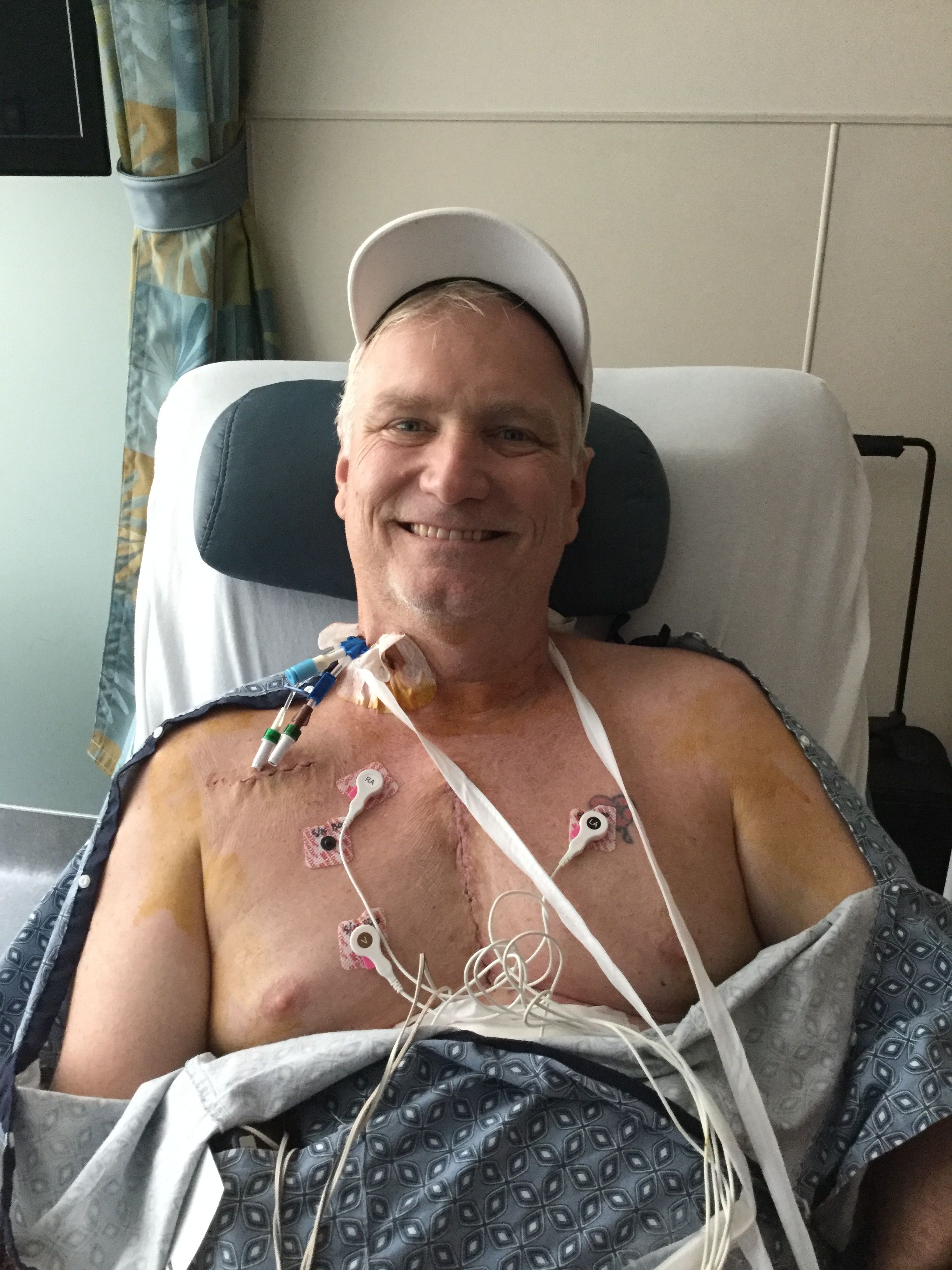 Day 2 postoperative. Bentall procedure with Bovine valve.