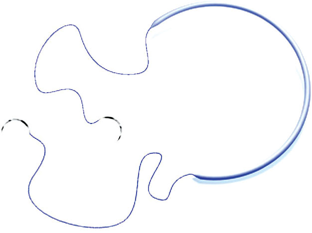 Kalangos Ring for Pediatric Cardiac Valve Surgery