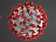 Surgeon Q&A: Is Heart Surgery Considered "Elective" During Coronavirus Outbreak?