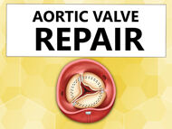 Aortic Valve Repair: Where Are We?
