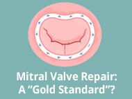 Mitral Valve Repair: The "Gold Standard" for Treating Mitral Regurgitation
