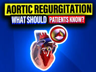 Aortic Regurgitation: What Should Patients Know?