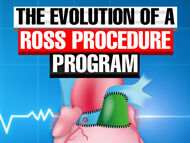 The Evolution of a Ross Procedure Program with Dr. Christopher Burke