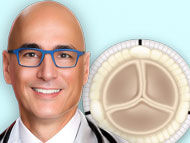 Patient Webinar: Ask Dr. Gerdisch Anything