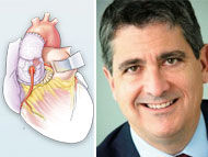 Cardiac Innovation: The BeSPoKE Procedure for Prosthesis Mismatch