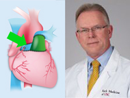 Patient Webinar: Advantages of the Ross Procedure