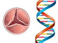 Ask Dr. McCarthy: Is Heart Valve Disease Genetic?